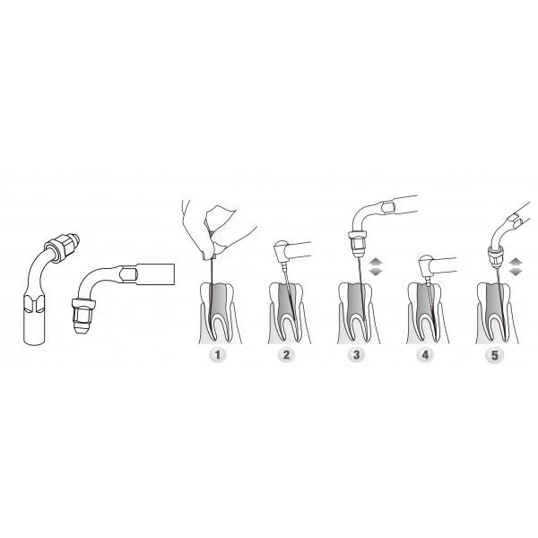 Scaler Tips DTE Compatible ED2