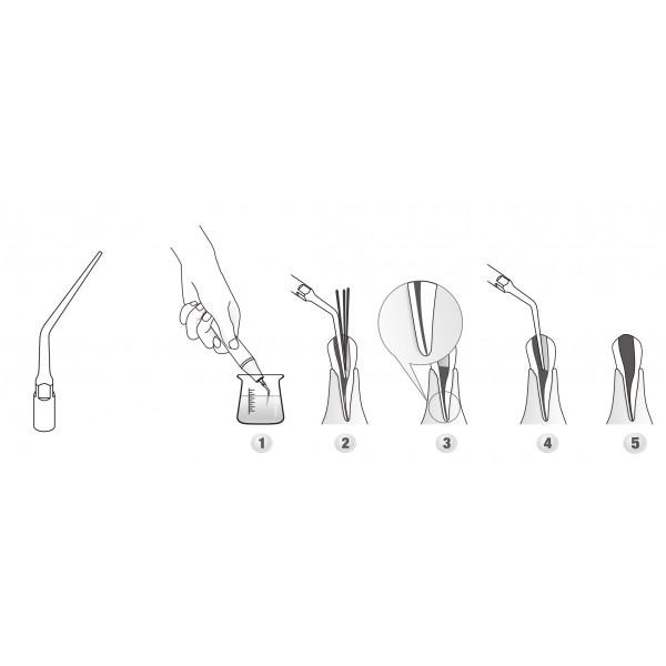 Scaler Tips DTE Compatible ED3