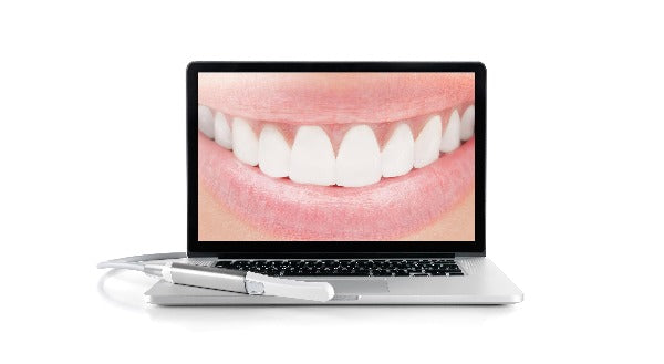 My Ray C-U2 Intraoral Camera (4440288329815)
