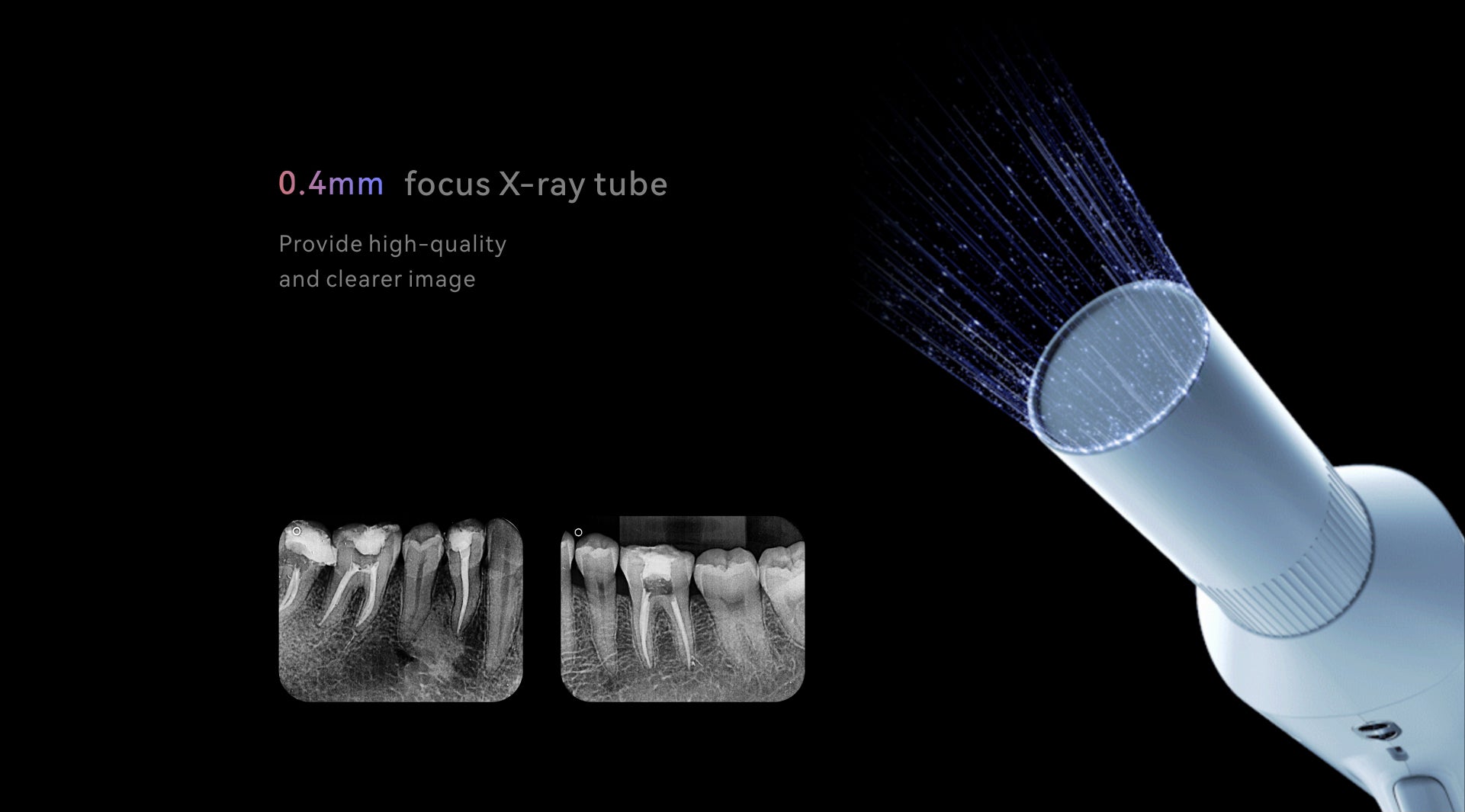 Woodpecker Ai-Ray Portable, Handheld X-Ray Machine (8284463038719)