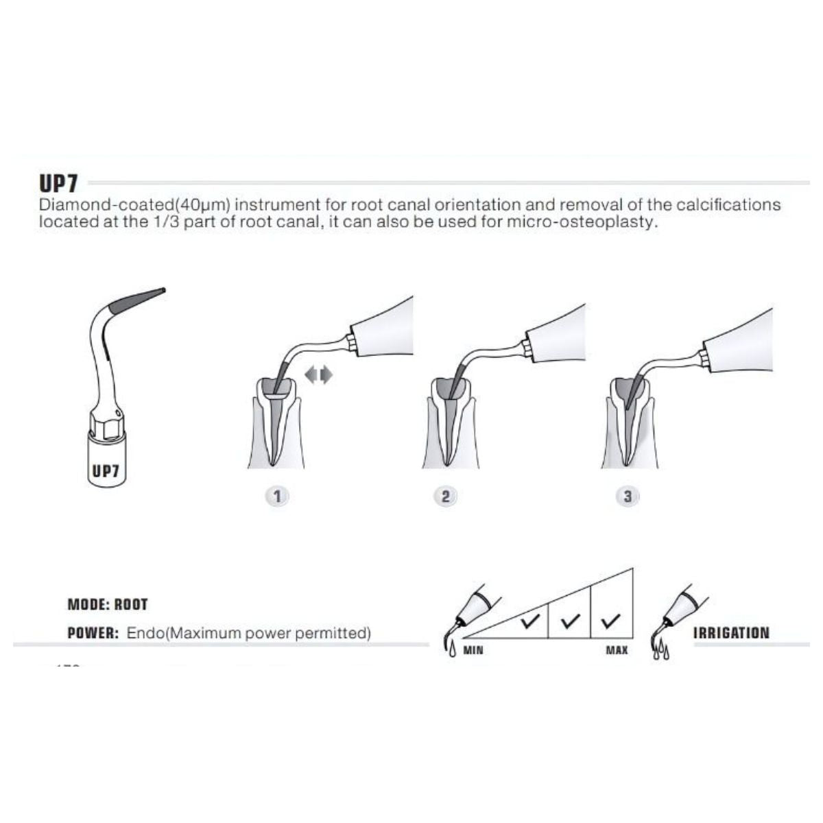 Woodpecker Periodontal Surgery Tips (Diamond Coated) (6713309888698)