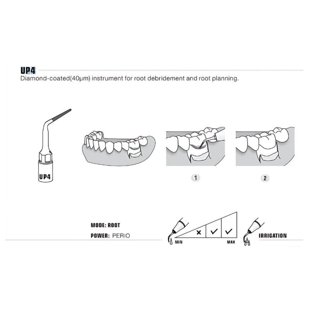 Woodpecker Periodontal Surgery Tips (Diamond Coated) (6713309888698)