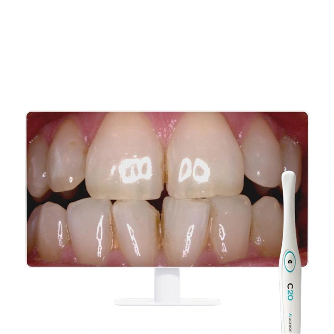 Acteon C20 Full HD Intraoral Camera