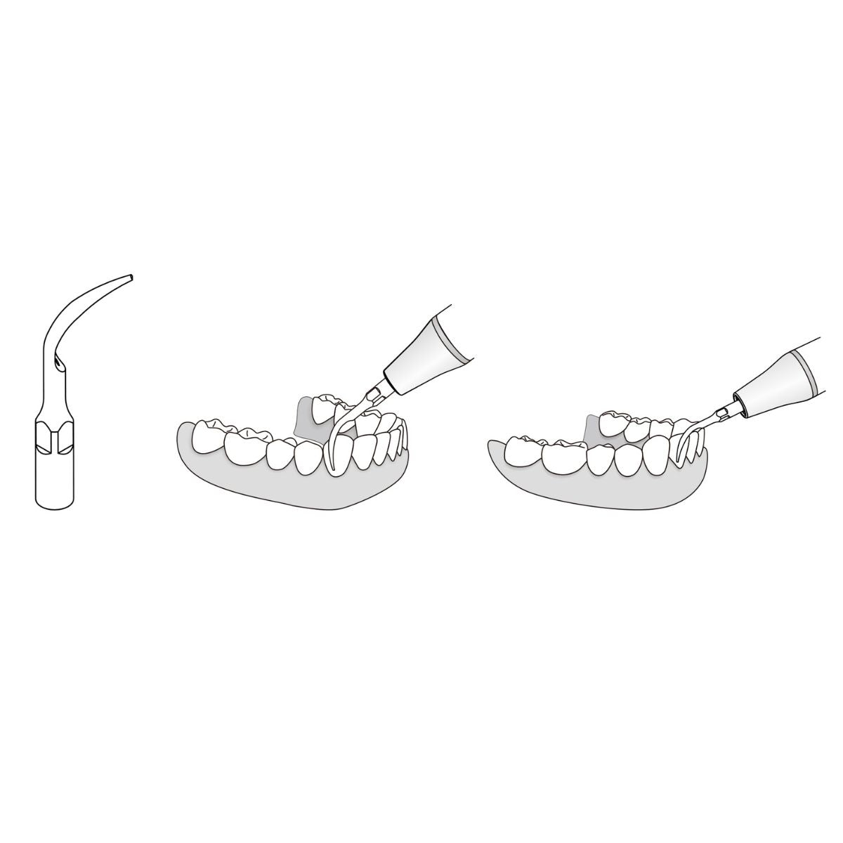 DTE Scaler Tips (Singles) (4440266670167)