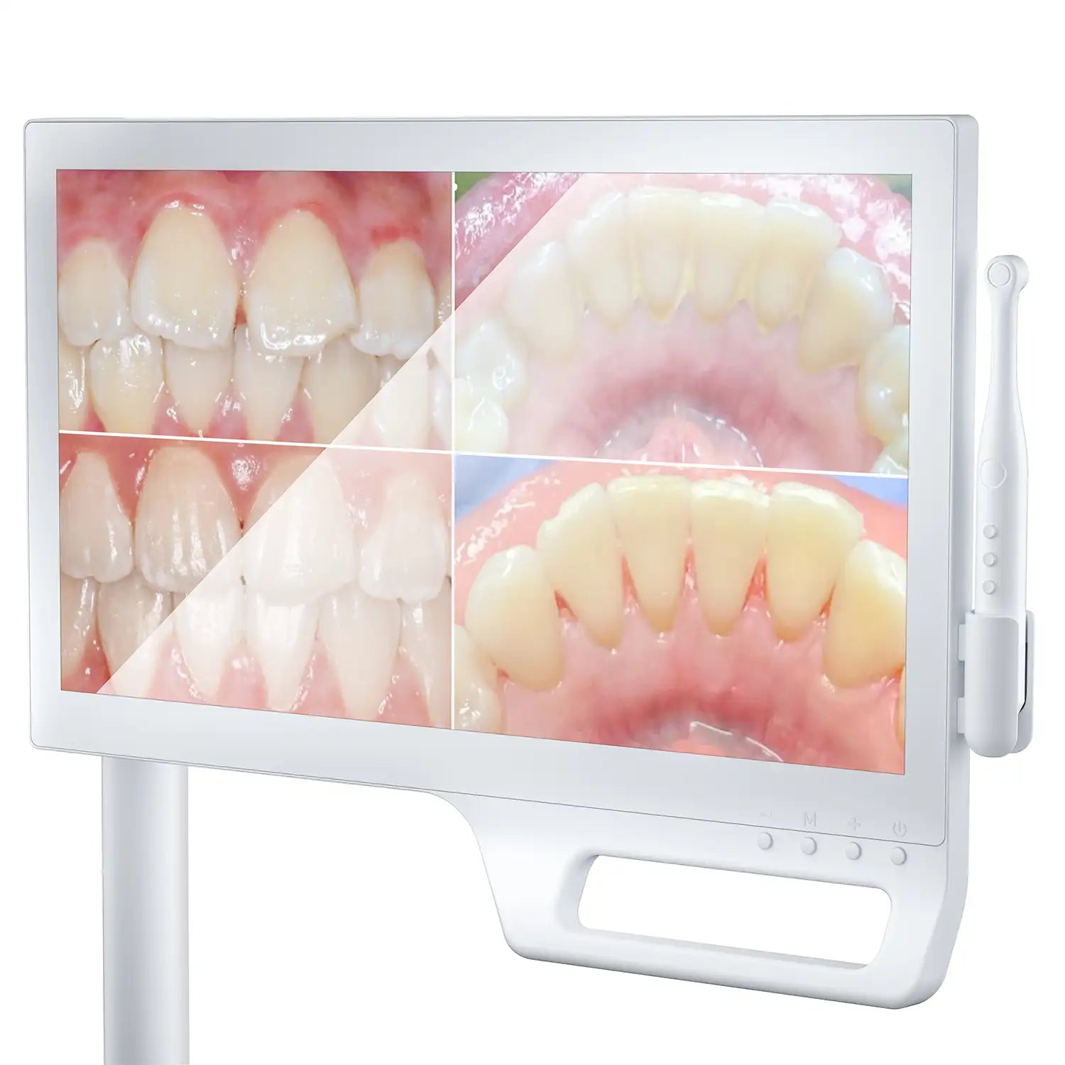 Intra Oral Camera KP Cam-one (8356940775679)