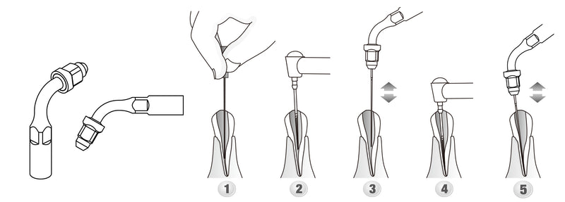 DTE-Satelec Endo Tips