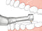 NSK Endo-Mate TC2 Cordless Endodontic Handpiece (4440348524631)