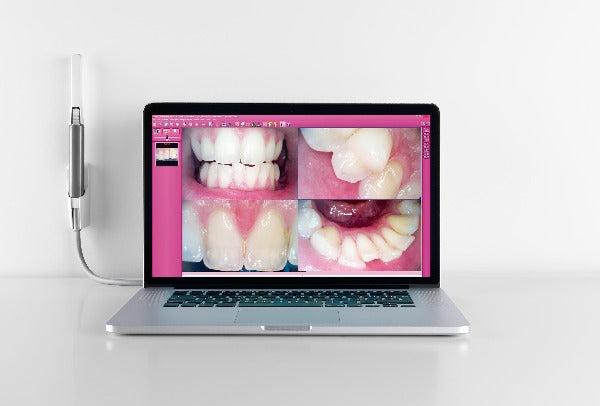 My Ray C-U2 Intraoral Camera (4440288329815)